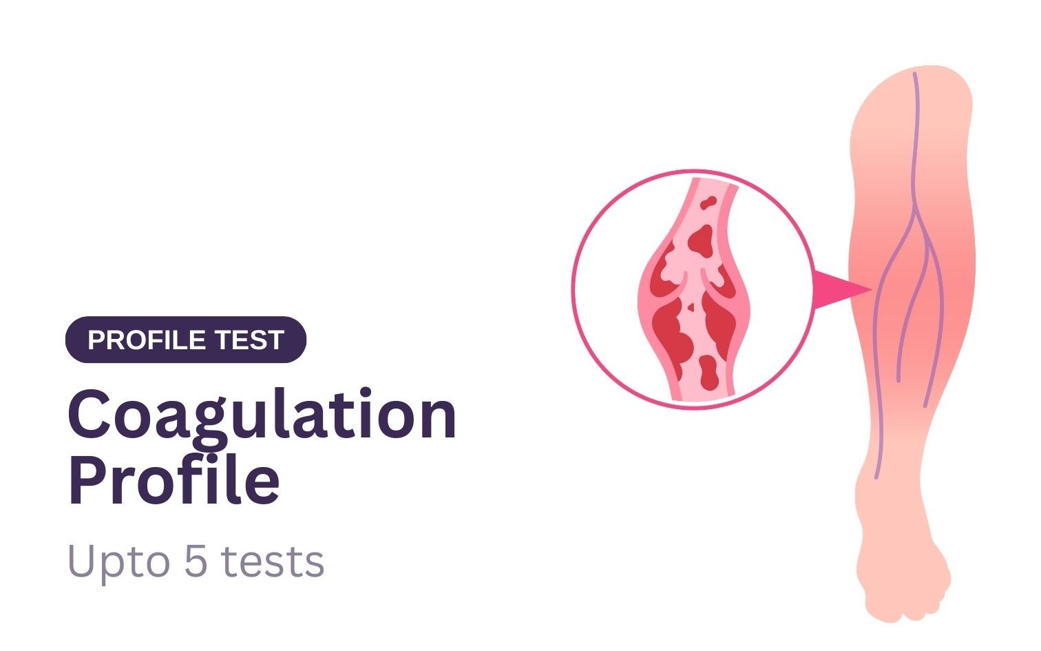 Coagulation Profile